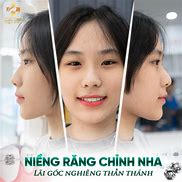 Nha Khoa Việt Đức Quận 3